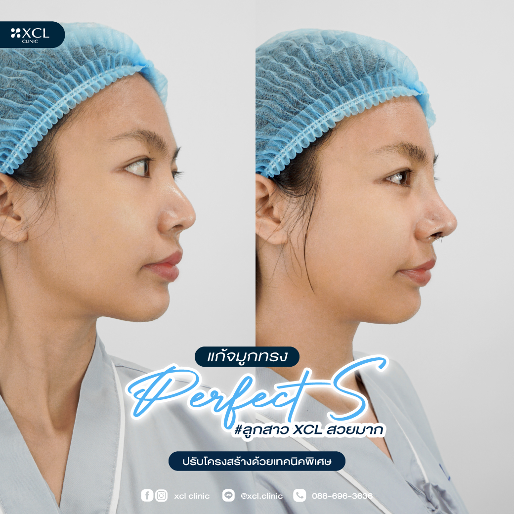 เปลี่ยนจมูกให้เข้ากับใบหน้า